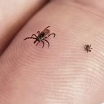 How to Avoid Tick Bites in Your Yard or While Hiking in the Woods, and What to Do If One Starts Feasting On You