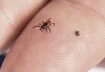 How to Avoid Tick Bites in Your Yard or While Hiking in the Woods, and What to Do If One Starts Feasting On You